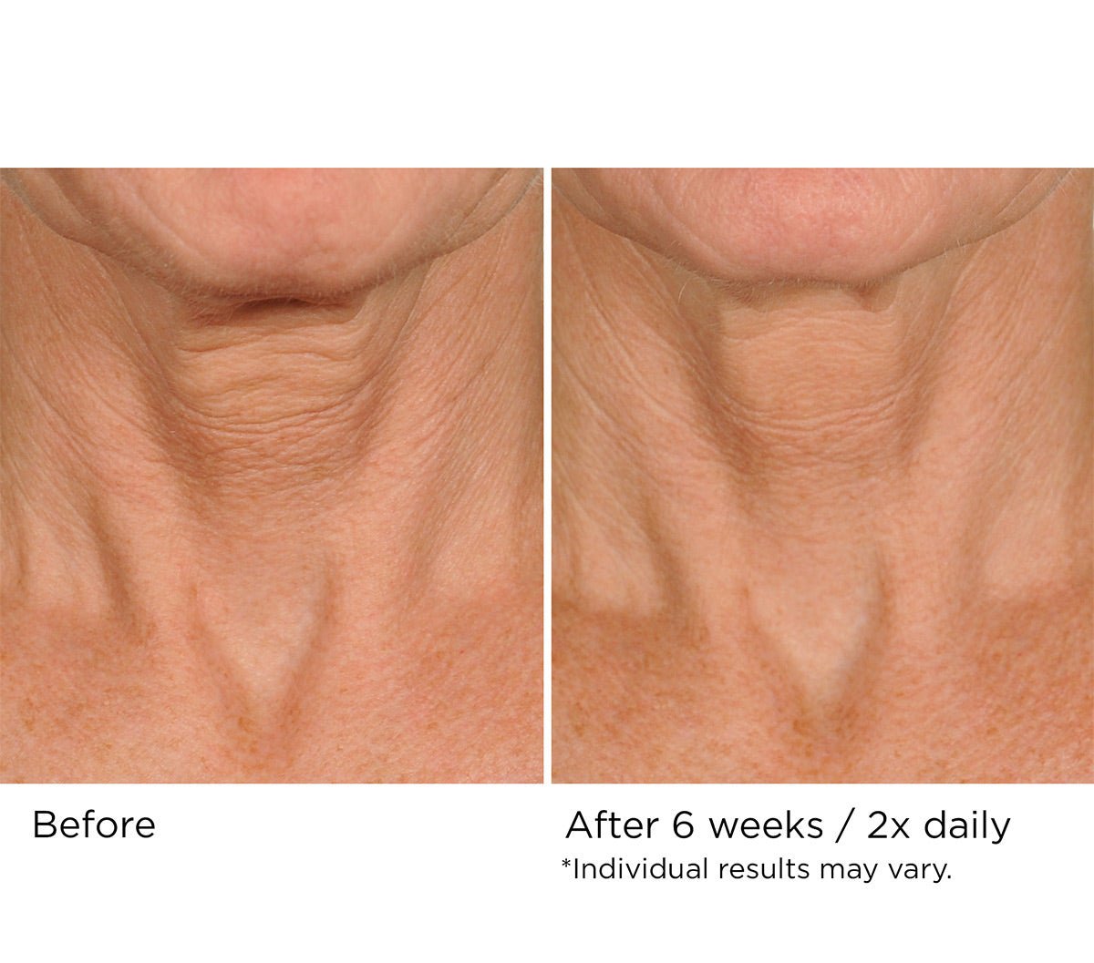 Deco - lift neck firming & lifting complex serum - Beauty Zohal