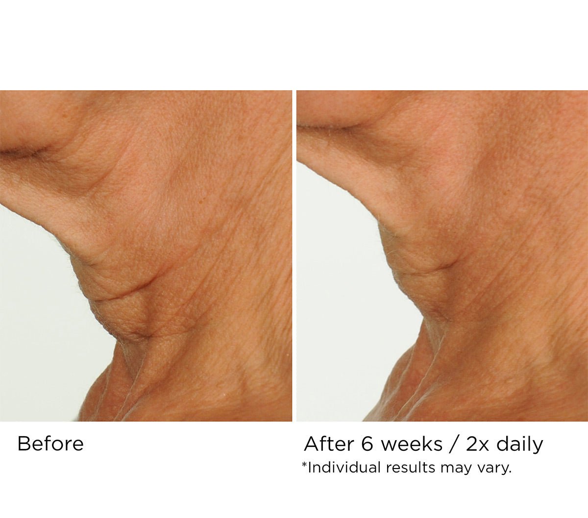 Deco - lift neck firming & lifting complex serum - Beauty Zohal