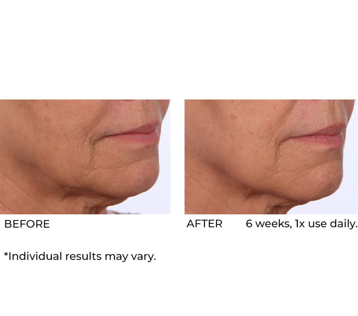 Dermaflect smart day cream - Beauty Zohal