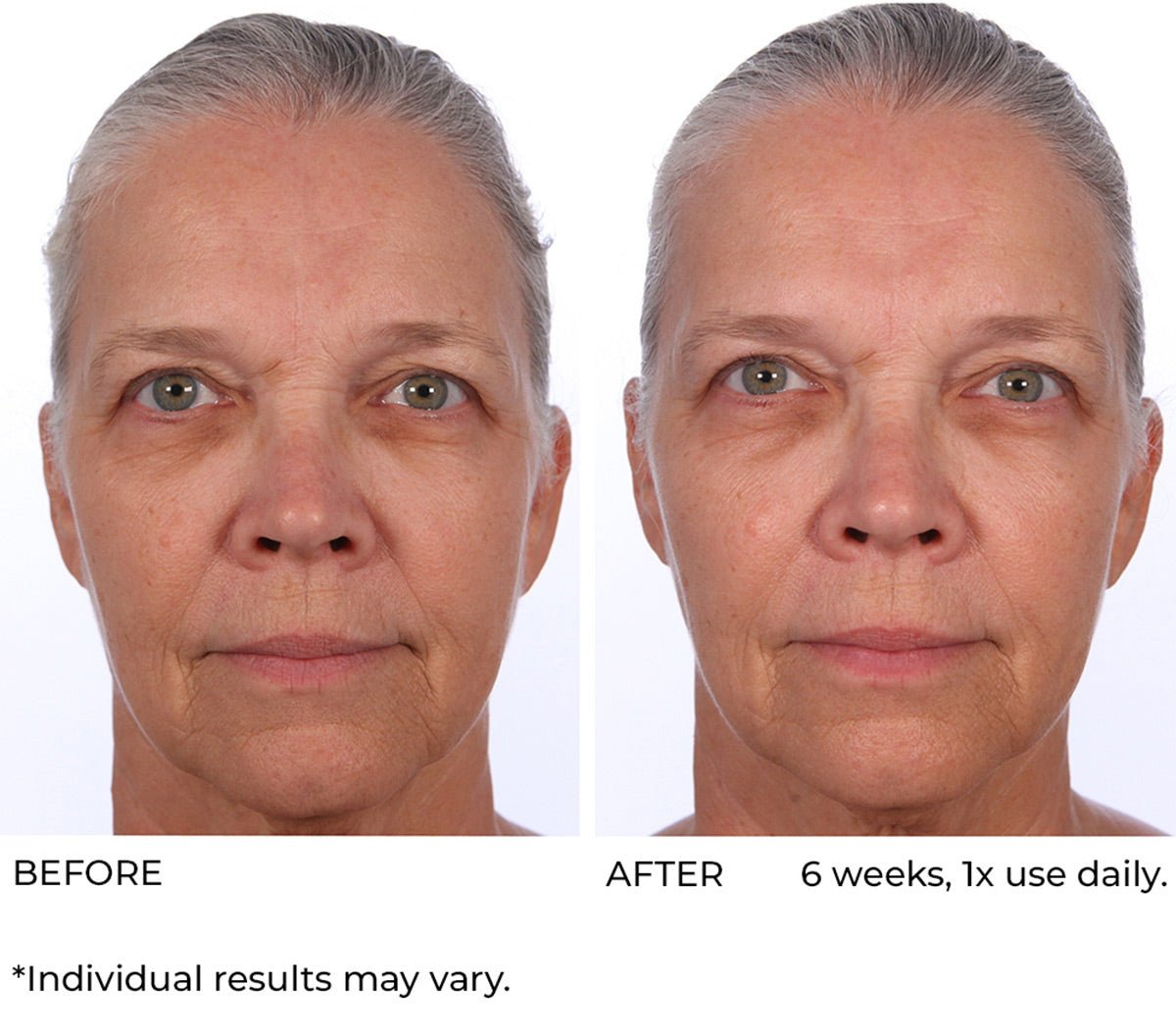 Dermaflect smart day cream - Beauty Zohal