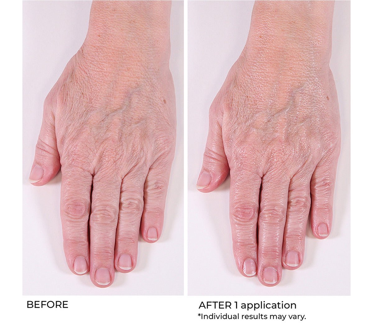 Hand Treatment Cream - Beauty Zohal