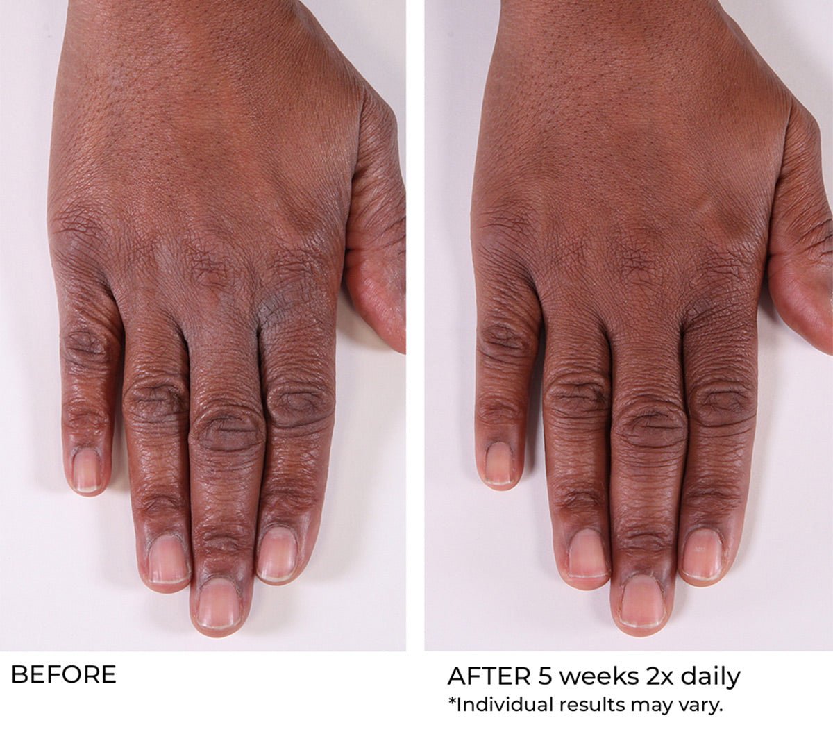 Hand Treatment Cream - Beauty Zohal
