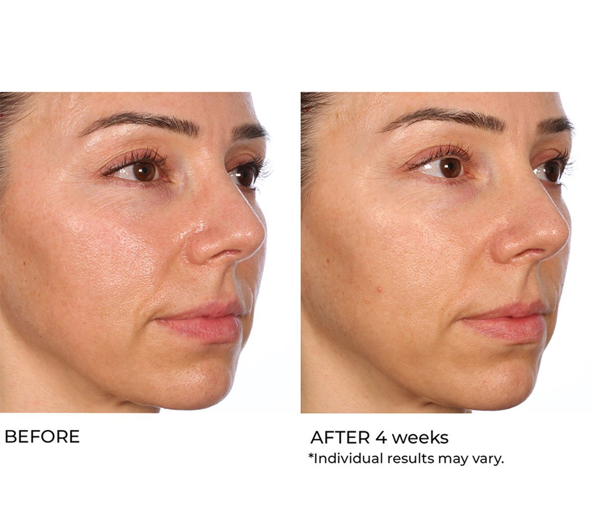 Hydro gel - Beauty Zohal