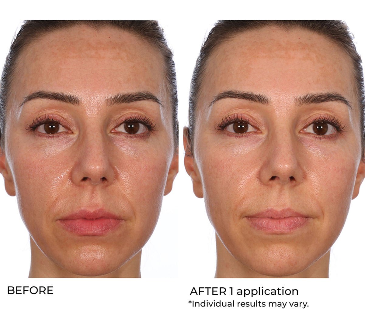 Hydro gel - Beauty Zohal