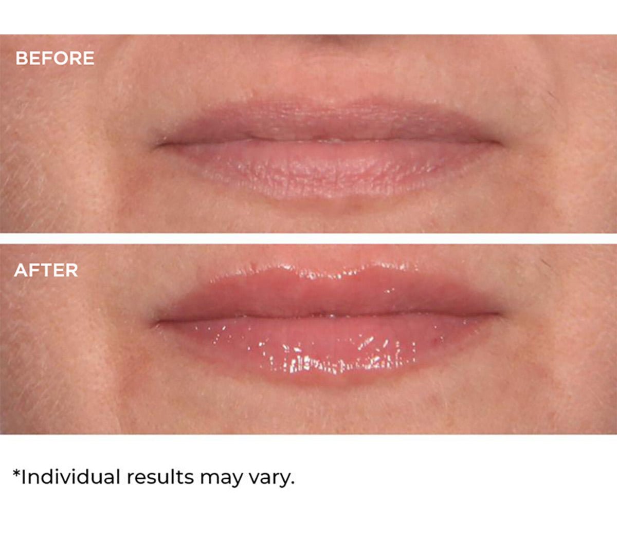 Hydro - screen for lips - Beauty Zohal