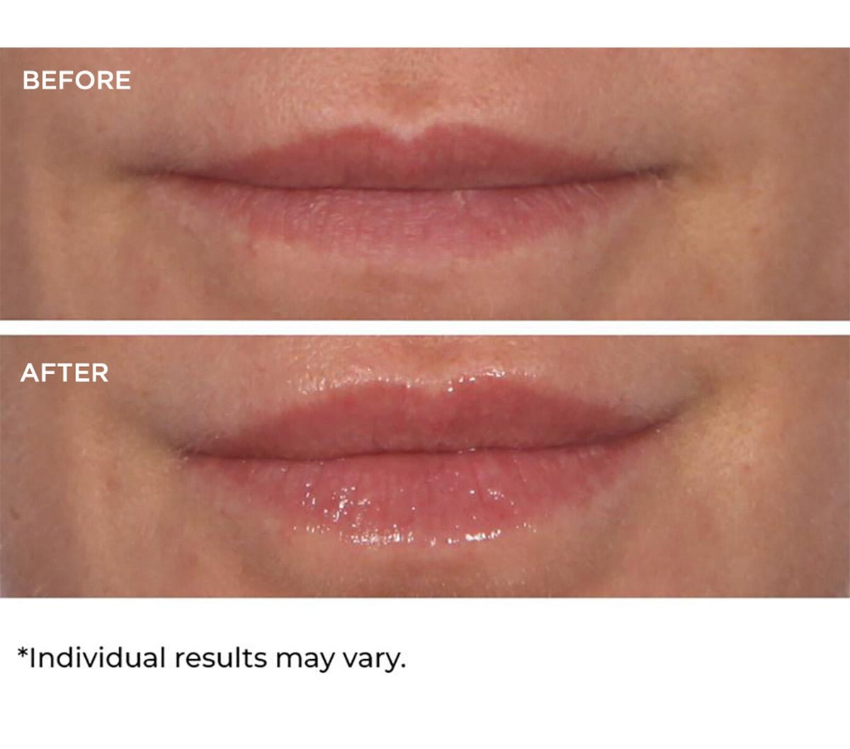 Hydro - screen for lips - Beauty Zohal