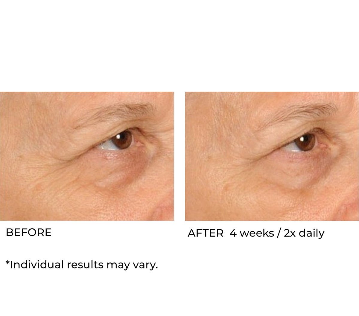 Hydro - screen serum - Beauty Zohal