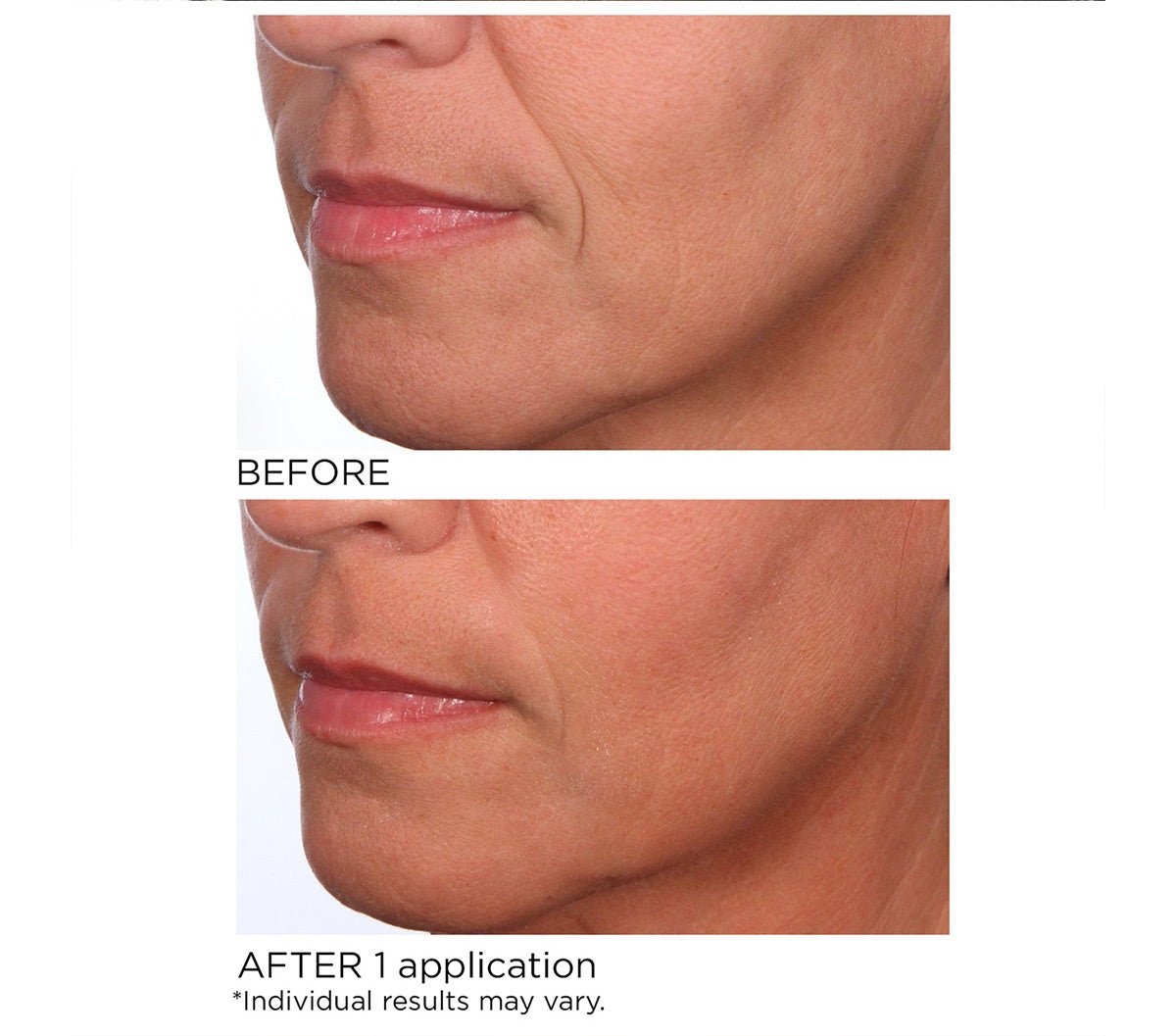 Instant up - lift masque - Beauty Zohal