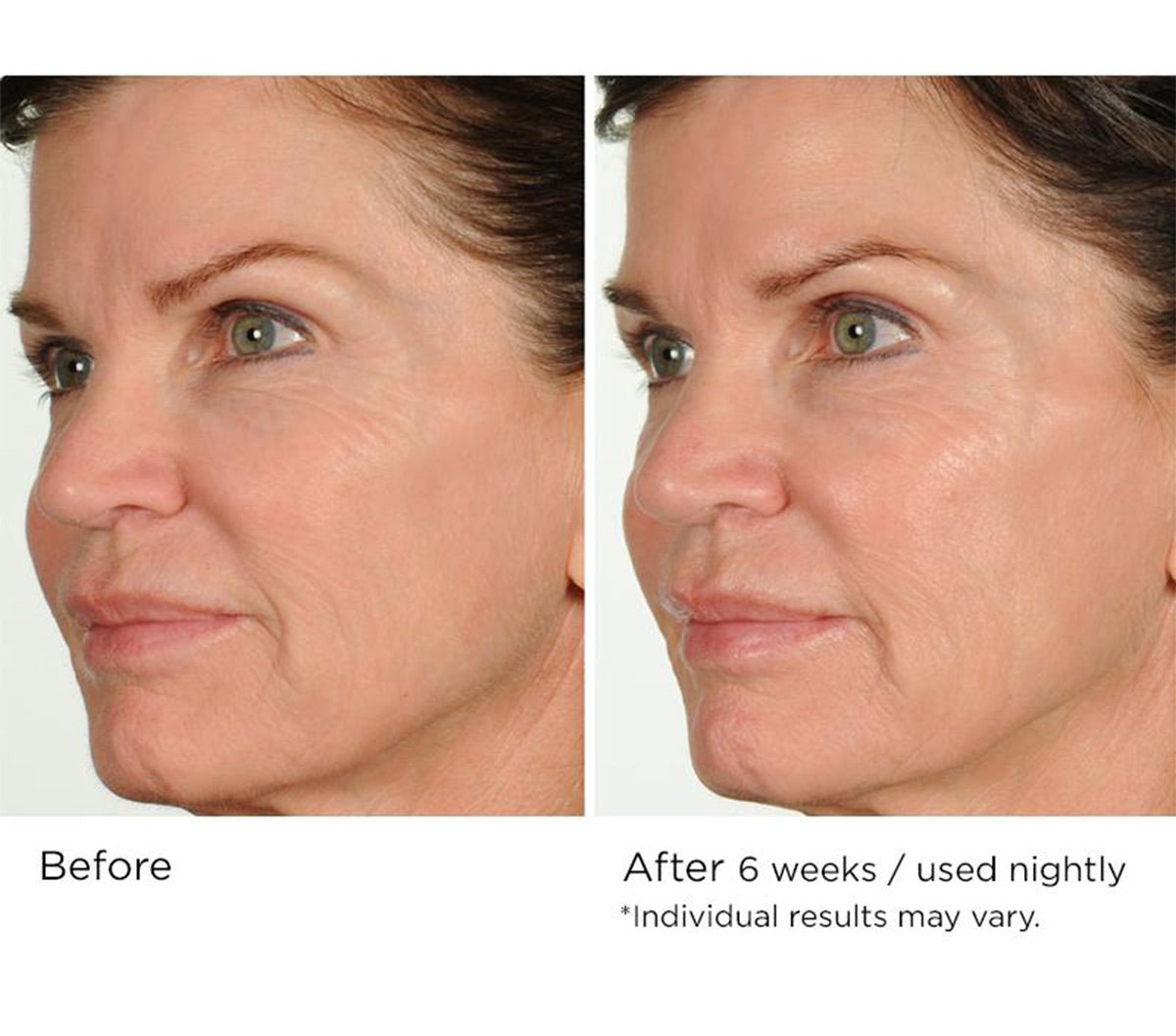 Night - Time age - defying concentrated vitamin C serum - Beauty Zohal