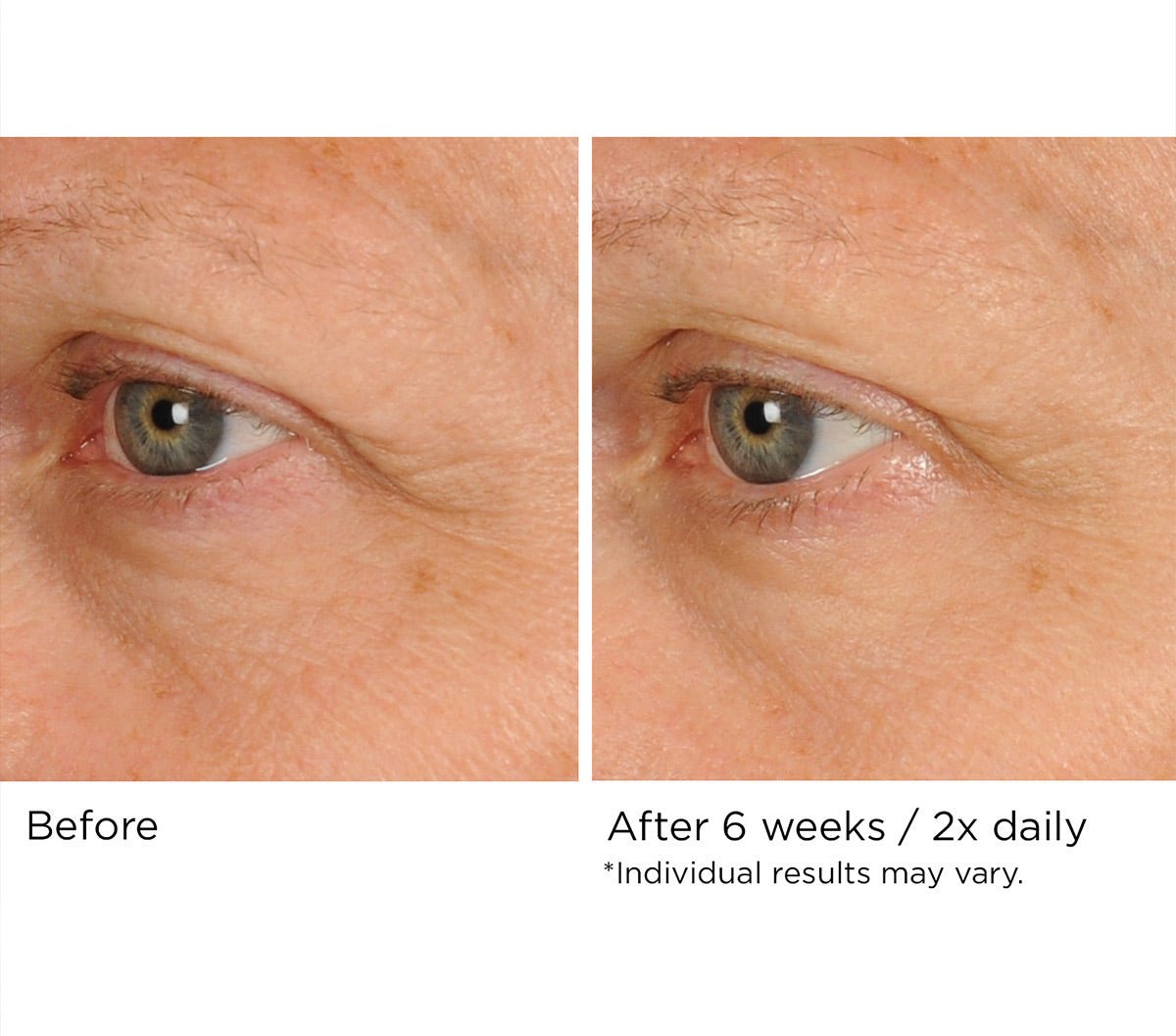 Peri - orbital eye complex - Beauty Zohal