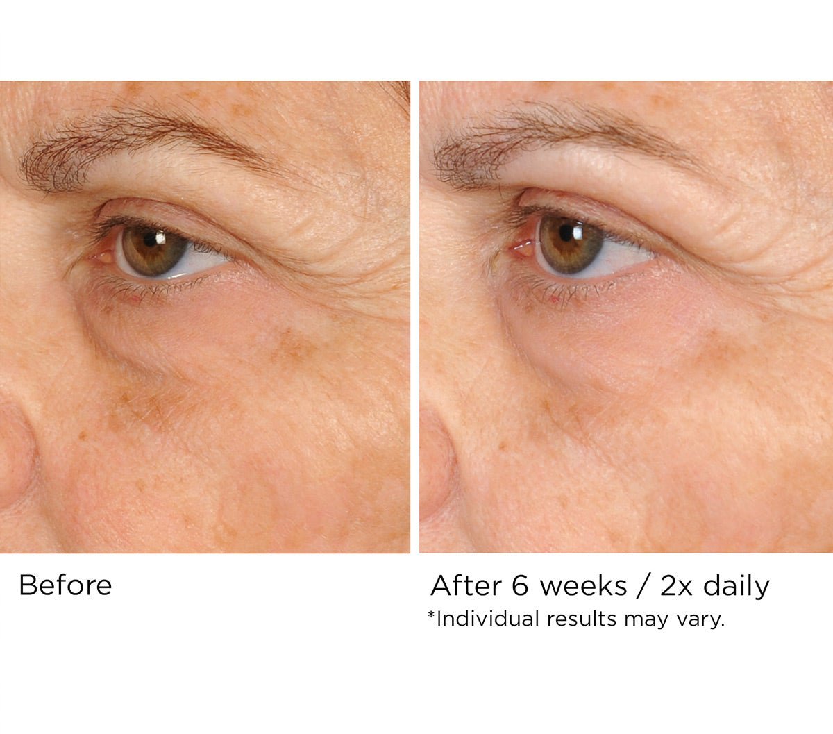 Peri - orbital eye complex - Beauty Zohal