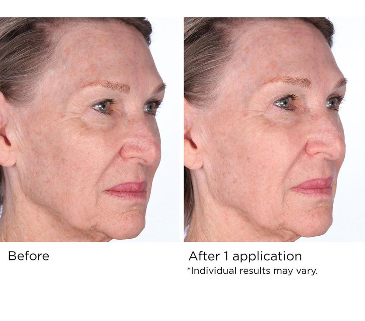 Quickfix Face & Neck Lift Masque - Beauty Zohal