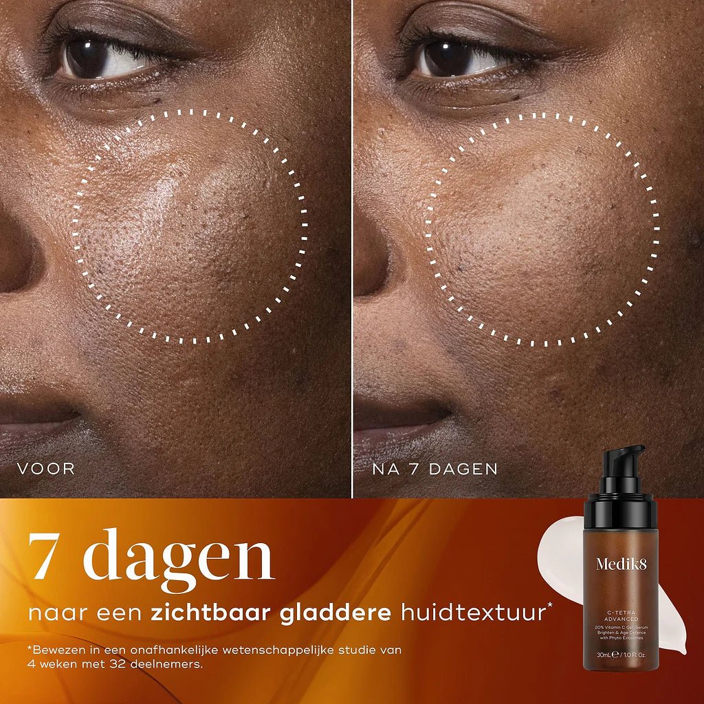 C-Tetra Advanced - Beauty Zohal