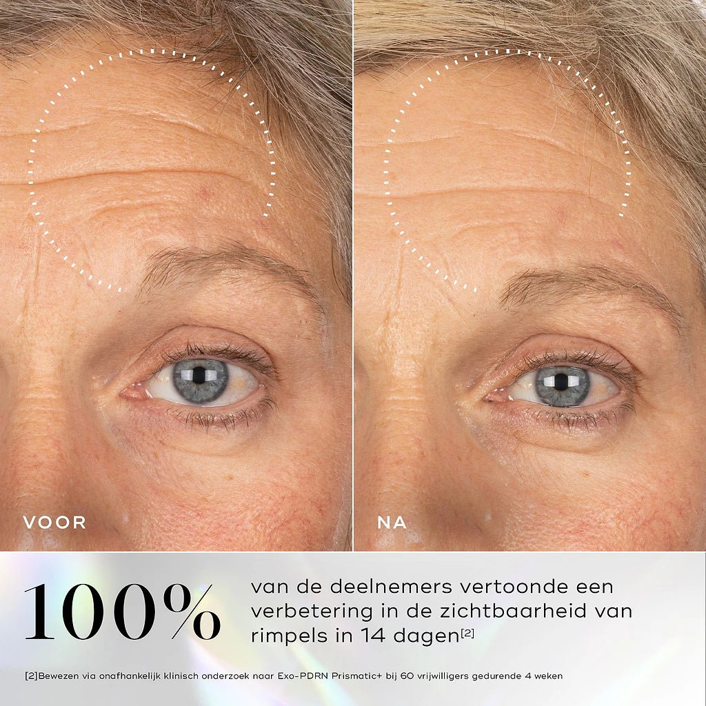 Exo-PDRN Prismatic+ - Beauty Zohal