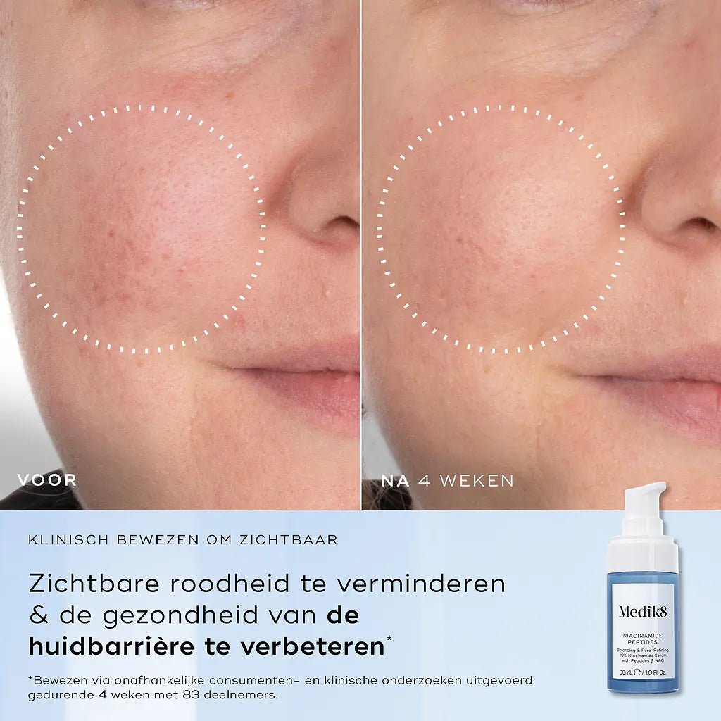 Niacinamide Peptides™ - Beauty Zohal
